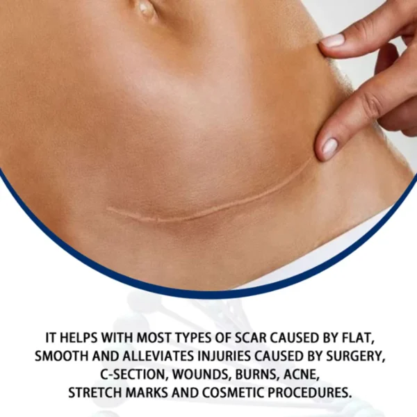 Scar Removal Surgery